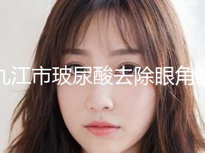 九江市玻尿酸去除眼角皱纹全新版价格表出炉(2024年3月均价为：5414元）